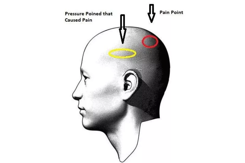 Pressure points demo